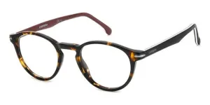 Carrera 310 086
